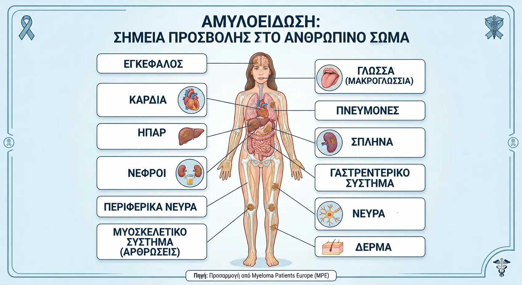 Αμυλοείδωση: σημεία προσβολής στο ανθρώπινο σώμα